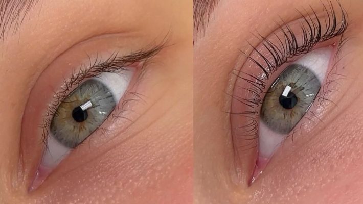 Πώς να επιλέξετε το σωστό κιτ ανόρθωσης βλεφαρίδων